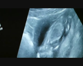 2010 Dec 20 TrimmedUltrasound.wmv